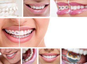 cosmetic dentistry