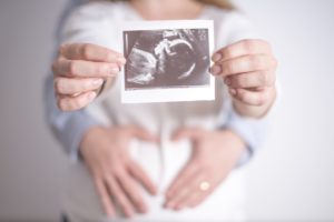 ultrasound of baby held by parents