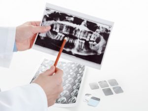 dental CT scan