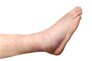 foot