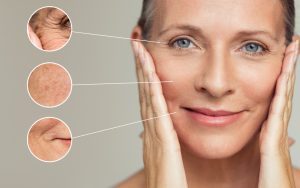 an adult woman with skin problems